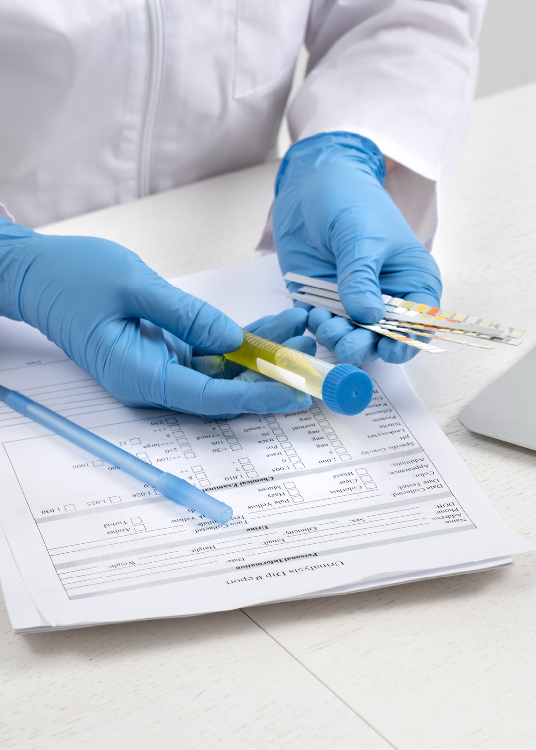 Lab doctor performing medical examination of urine